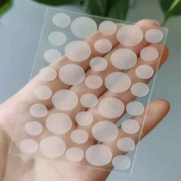 Acne pletter